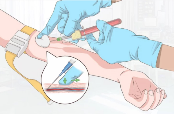 Перед операцией проводится ряд исследований крови